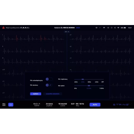 Aparat EKG OPUS 1